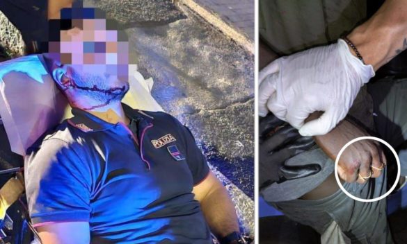 Catania, due poliziotti aggrediti in centro durante un controllo: feriti con cocci di bottiglia e tirapugni artigianale