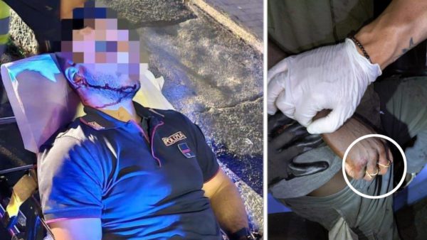 Catania, due poliziotti aggrediti in centro durante un controllo: feriti con cocci di bottiglia e tirapugni artigianale