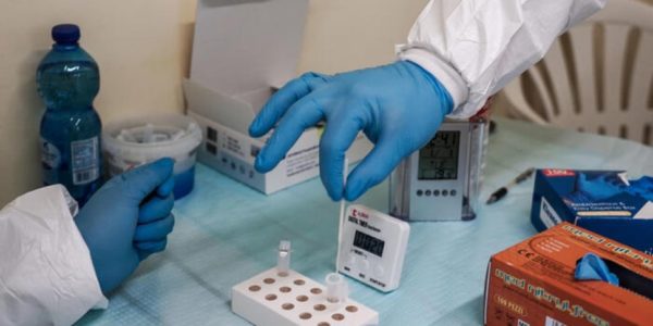 Erice, lo studio sul Covid: le proteine spike accelerano la formazione di coaguli