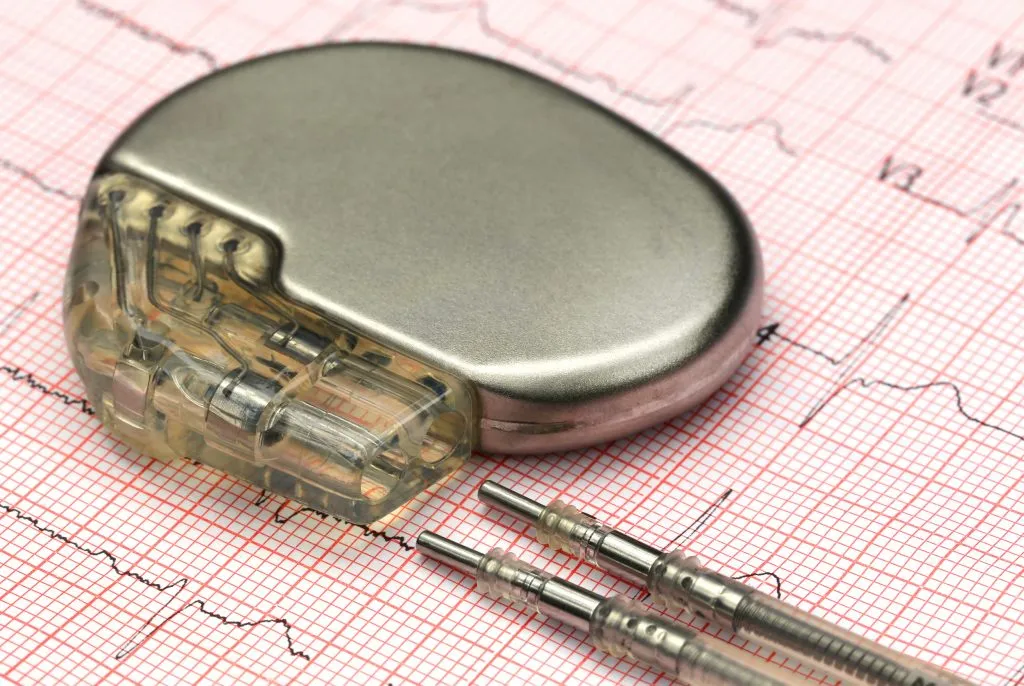Pacemaker senza fili implantato a Palermo e Agrigento